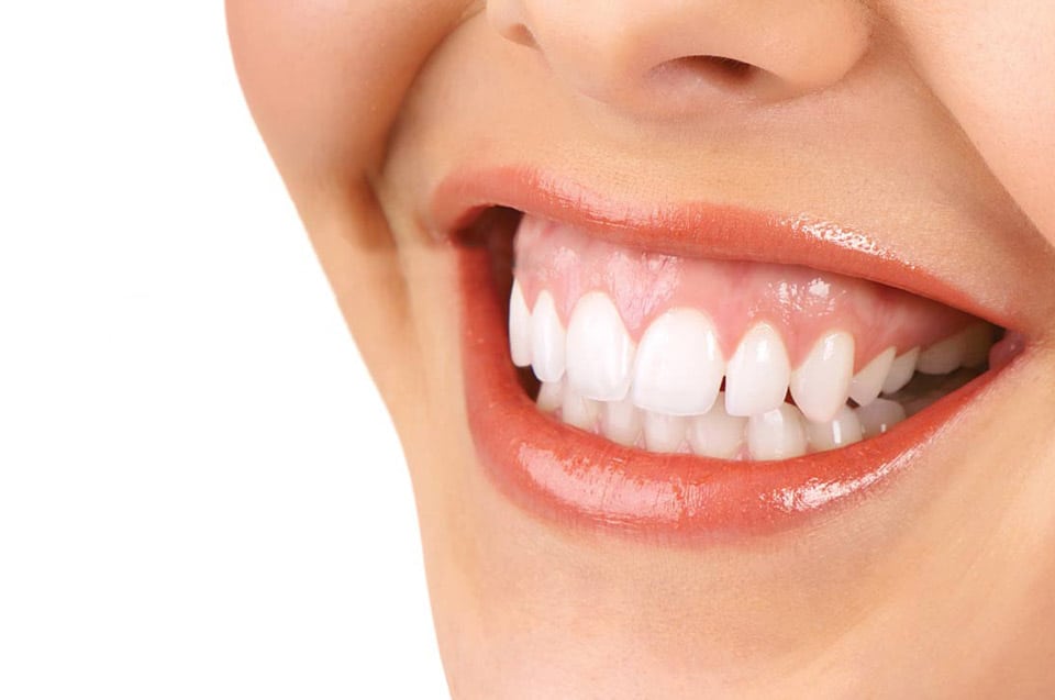 what can be done about a gummy smile