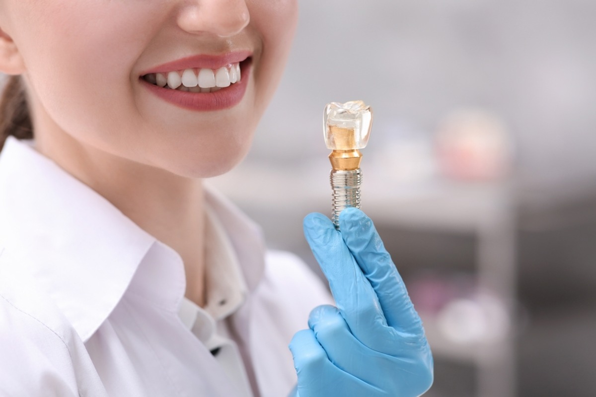 how dental implants can improve your smile and confidence